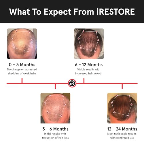 iRestore Laser Hair Growth System for Men & Women