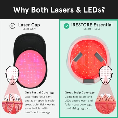 iRestore Laser Hair Growth System for Men & Women