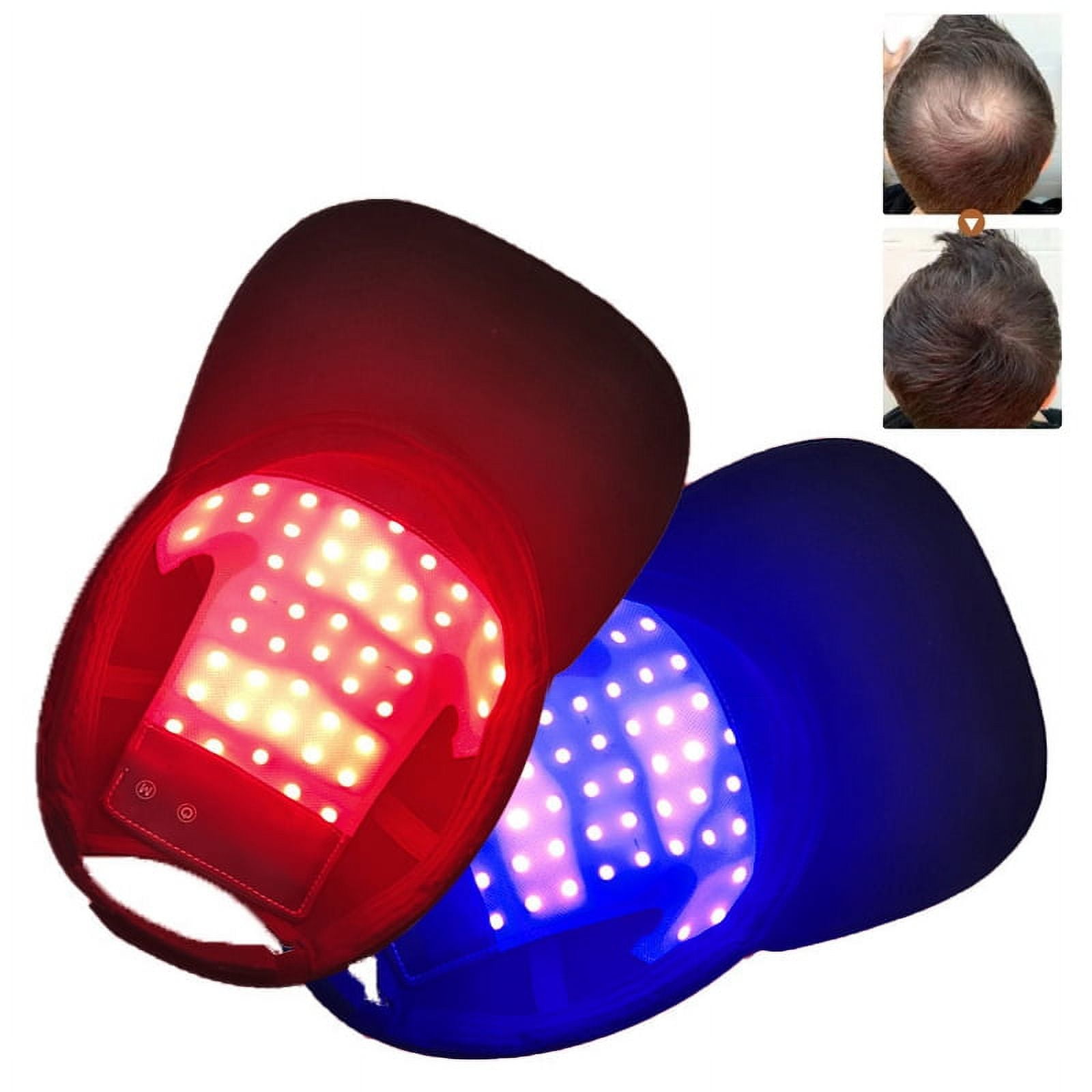 Red Light Therapy Hair Growth Cap Machine