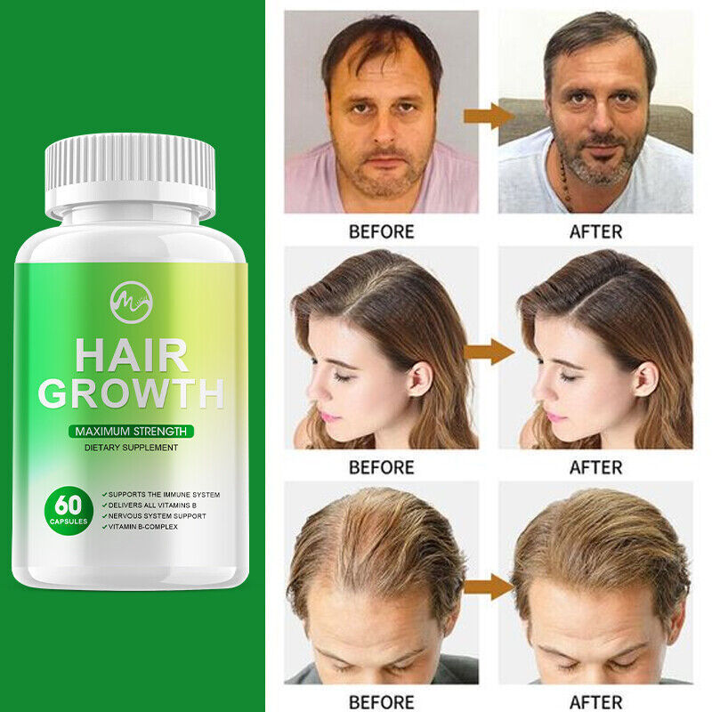 Hair Growth Vitamins for Men & Women - 60 Caps