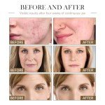 Fortifying Black Seed & Rosehip Face Oil Duo