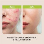 Natural Clarifying Face Wash with Salicylic Acid