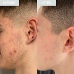 Skinician Purifying Cleansing Gel for Oily Skin
