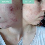 Skinician Purifying Cleansing Gel for Oily Skin