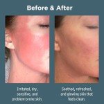 Gentle Face Wash for All Skin Types, 150ml