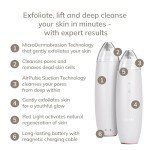 GESKE Smart Microdermabrasion Blackhead Remover Tool