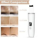 Ultrasonic Face Scrubber with 4 Modes and Covers