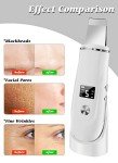 Ultrasonic Skin Scrubber and Blackhead Remover Tool