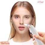 4-Mode Electric Blackhead Remover Vacuum Tool