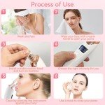 4-Mode Electric Blackhead Remover Vacuum Tool