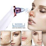 Rechargeable Blackhead Remover Vacuum for All Skin
