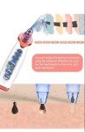 Rechargeable Blackhead Remover Vacuum for All Skin