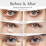 Bloomora Under Eye Patches for Dark Circles