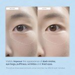 Korean Eye Gel Patches for Puffiness & Dark Circles