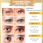 24K Gold Under Eye Gel Masks for Puffiness