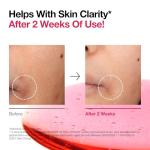 ANUA 10% Niacinamide Dark Spot Serum 30ml