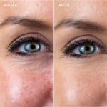 Gatineau Miracle Eye & Face Contour Cream 11ml