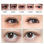 Gold Under Eye Masks - 15 Pairs for Dark Circles