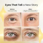 24K Gold Eye Treatment Masks for Dark Circles