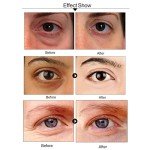 24K Gold Collagen Under Eye Masks for Dark Circles