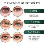 Green Tea Eye Gel Patches for Puffiness & Dark Circles