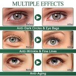 Eveellyn Under Eye Gel Patches for Dark Circles