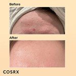 COSRX Advanced Snail 96 Essence - Hydrating Serum
