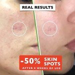 Organic Vitamin C Serum with Hyaluronic Acid & Niacinamide