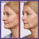 L'Oreal Paris Revitalift Retinol Night Serum 30ml