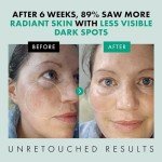 Eclat Niacinamide Serum for Brightening & Pore Minimizing