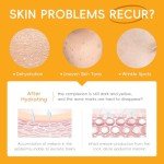 LAIKOU Vitamin C Skincare Set for All Skin Types