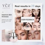 Electric Eye Cream Massager for Dark Circles