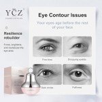 Electric Eye Cream Massager for Dark Circles