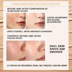 Full Coverage Concealer Palette for Dark Circles