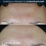 RoC Multi Correxion Hydrate & Plump Moisturizer SPF30