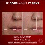 L’Oréal Paris Laser Renew Anti-Aging Day Cream