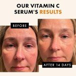 Glow Up Vitamin C Serum with Hyaluronic Acid
