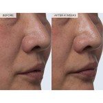 Glow Recipe PHA + BHA Pore Minimizing Toner
