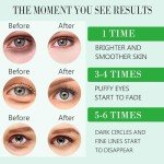 Aloe Vera Under Eye Gel Patches - 60 Pcs