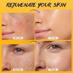 Turmeric & Kojic Acid Brightening Face Scrub