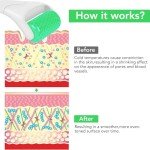 LATME Ice Roller for Face and Eye Relief