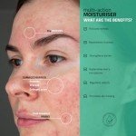 Non-Comedogenic Moisturizer with Niacinamide & Aloe Vera