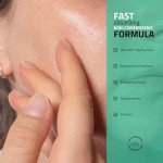 Non-Comedogenic Moisturizer with Niacinamide & Aloe Vera