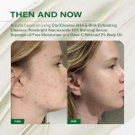 Facetheory Supergel Oil-Free Moisturiser for Oily Skin