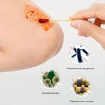 Disposable Iodine Cotton Swabs for Emergency Kits