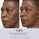 TheraFace PRO Microcurrent Facial Massager & Sculptor