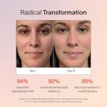 Solawave Radiant Renewal Red Light Therapy Wand