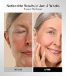 INIA Rechargeable Red Light Therapy Face Mask