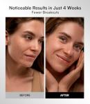 INIA Rechargeable Red Light Therapy Face Mask