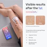Braun Smart IPL 7: At-Home Laser Hair Removal